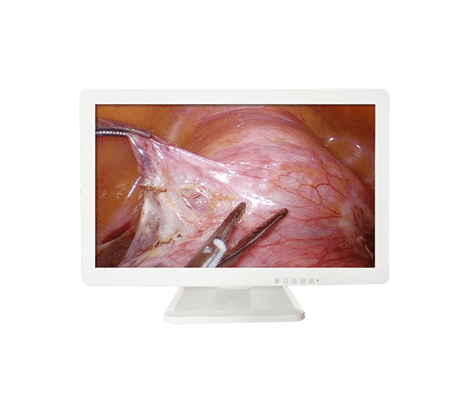 3D Medical Endoscope Monitor 32＂