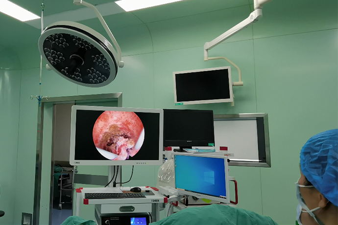 【Hysteroscopy】Diagnostic symptoms, contraindications, etc. of hysteroscopic surgery.