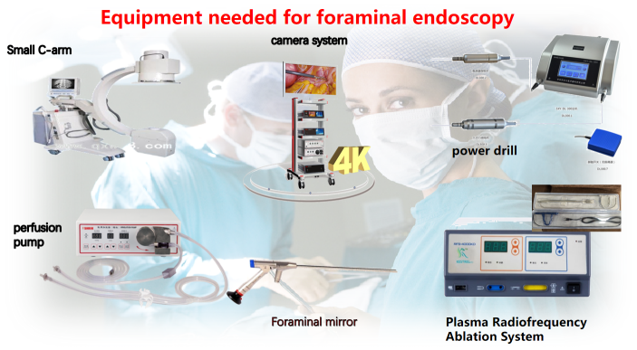 PTED(percutaneous transforaminal endoscopic discectomy)