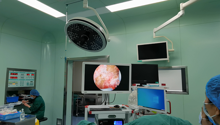 Advantages of hysteroscopy surgery.