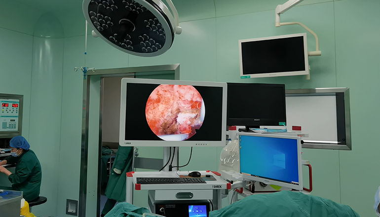 hysteroscopic adhesectomy