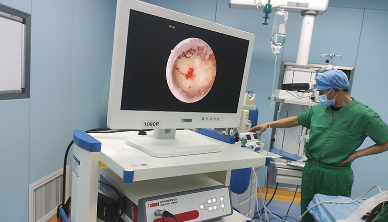 Hysteroscopic endometrial polypectomy