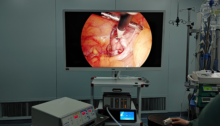 Laparoscopic repair of gastroduodenal ulcer perforation