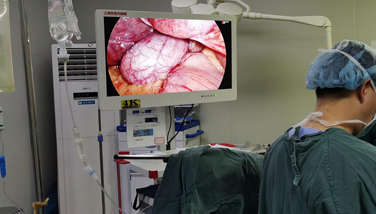 Laparoscopic fenestration of giant hepatic cyst