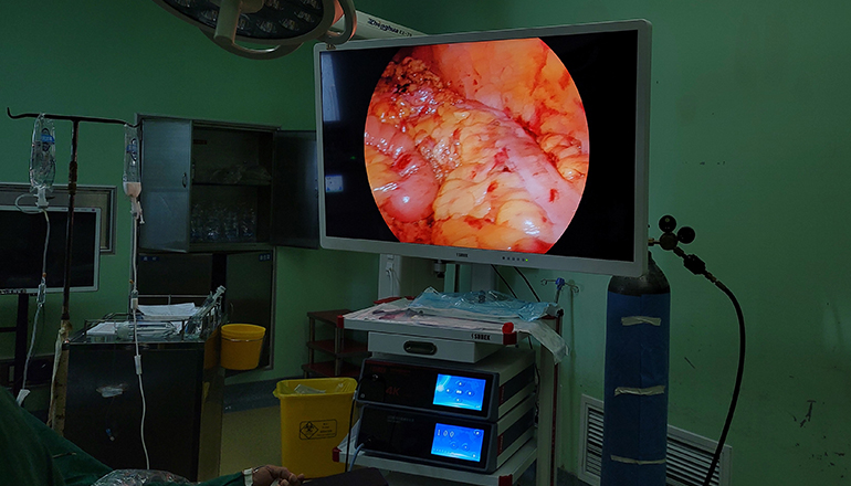 4K Ultra HD Endoscopic Camera System