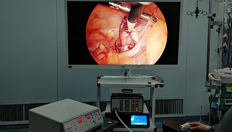 4K Ultra HD Endoscopic Camera System Technology