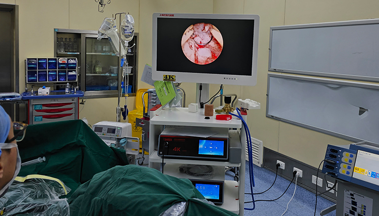 Application of 4K endoscopic technology in cystoscopy surgery