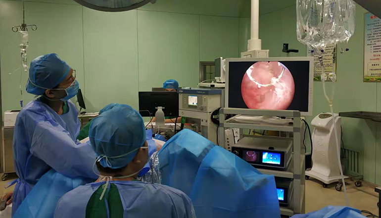 hysteroscopic myomectomy